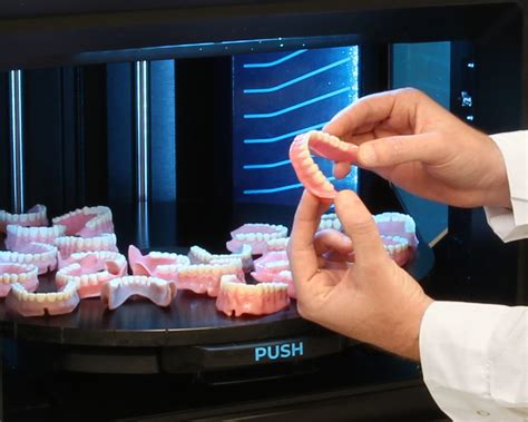 3d printed dentures reviews|Current challenges for 3D printing complete dentures: .